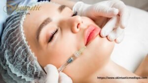 Lip Fillers Riverside
