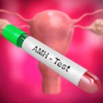 AMH Levels and Fertility