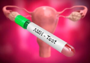 AMH Levels and Fertility
