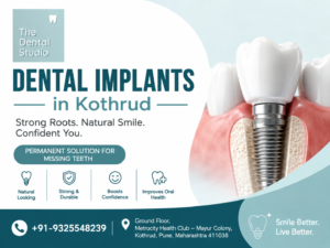 Dental Implants in Kothrud