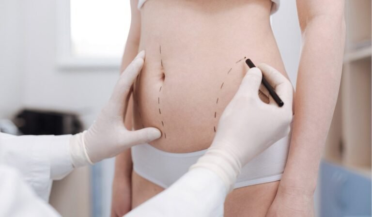 Liposuction in Dubai