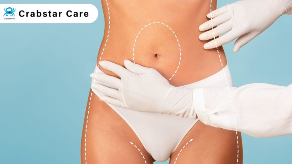 Why Liposuction Care Services is the Need of Hour in Palo Alto, CA