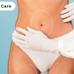 Why Liposuction Care Services is the Need of Hour in Palo Alto, CA