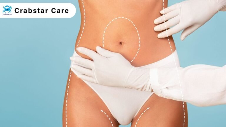 Why Liposuction Care Services is the Need of Hour in Palo Alto, CA