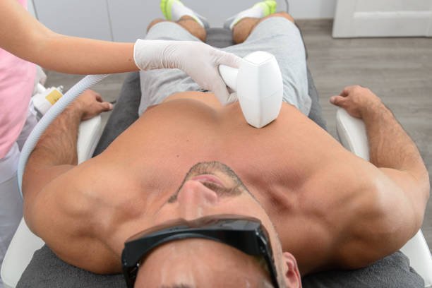 Laser hair removal on mans chest. man in a goggles. therapist in a pink t-shirt