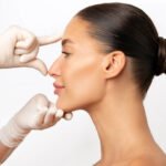 Rhinoplasty