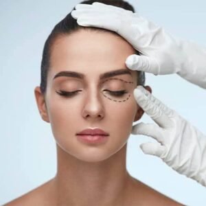 Blépharoplastie à Paris