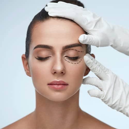 Blépharoplastie à Paris
