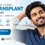 hair transplant clinic in Chennai