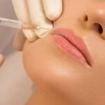 Fillers Injection in Dubai