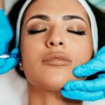 Microneedling Facial Treatment in Lauderdale Beach