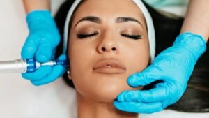 Microneedling Facial Treatment in Lauderdale Beach