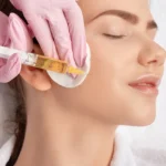 PRP Facial Treatments in Pembroke Pines