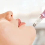exosome-treatment-dr-azra-vaziri-1024x623