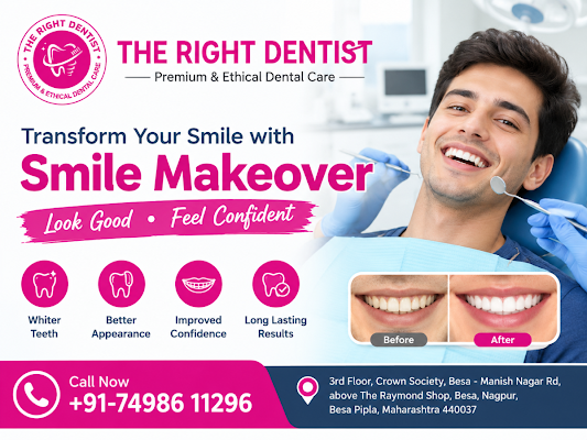 smile makeover dentist nagpur
