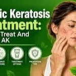 Actinic keratosis supplements for skin health and antioxidant support