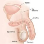 Hydrocele-Supplements-for-Healthy-Weight