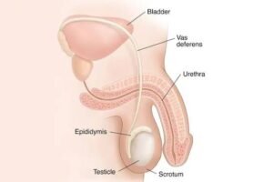 Hydrocele-Supplements-for-Healthy-Weight