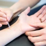 Page_1_Acupuncture_and_dry_needling
