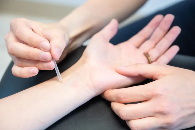 Page_1_Acupuncture_and_dry_needling