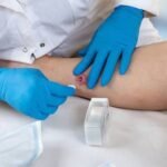 Can You Get Hidradenitis Suppurativa on Your Face? What Research Says
