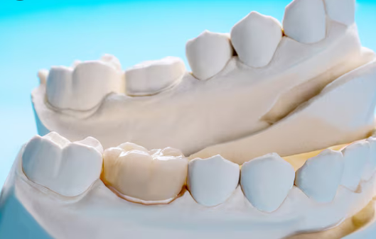 dental crowns athens al