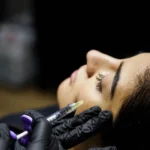 botox treatment for face