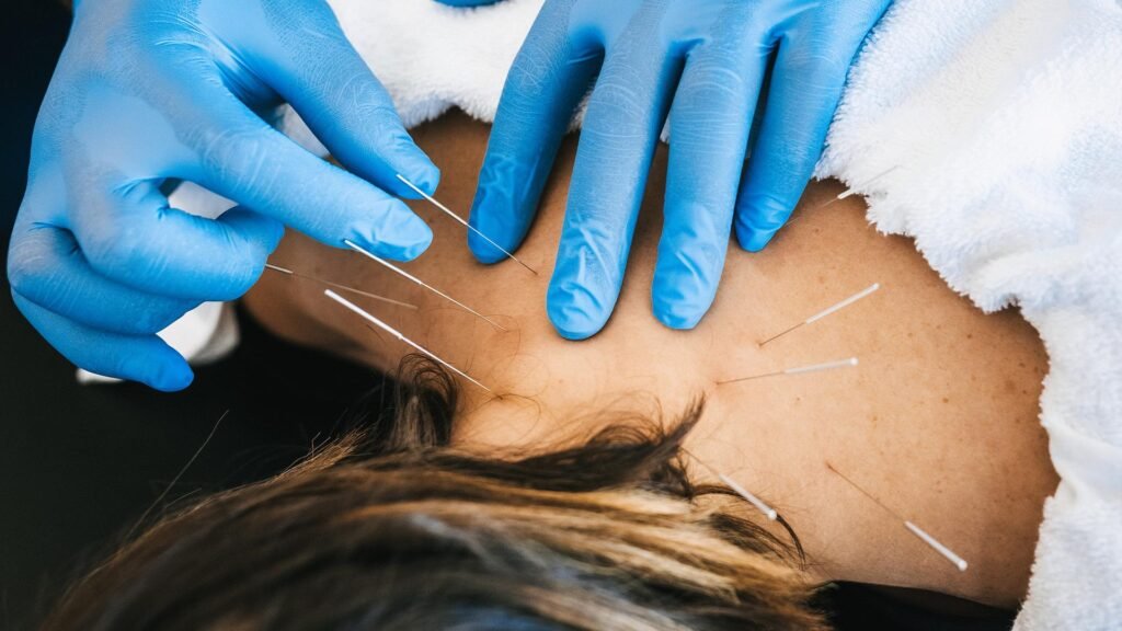 dry-needling-1920x1080px