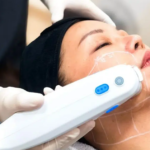 ultherapy treatment singapore