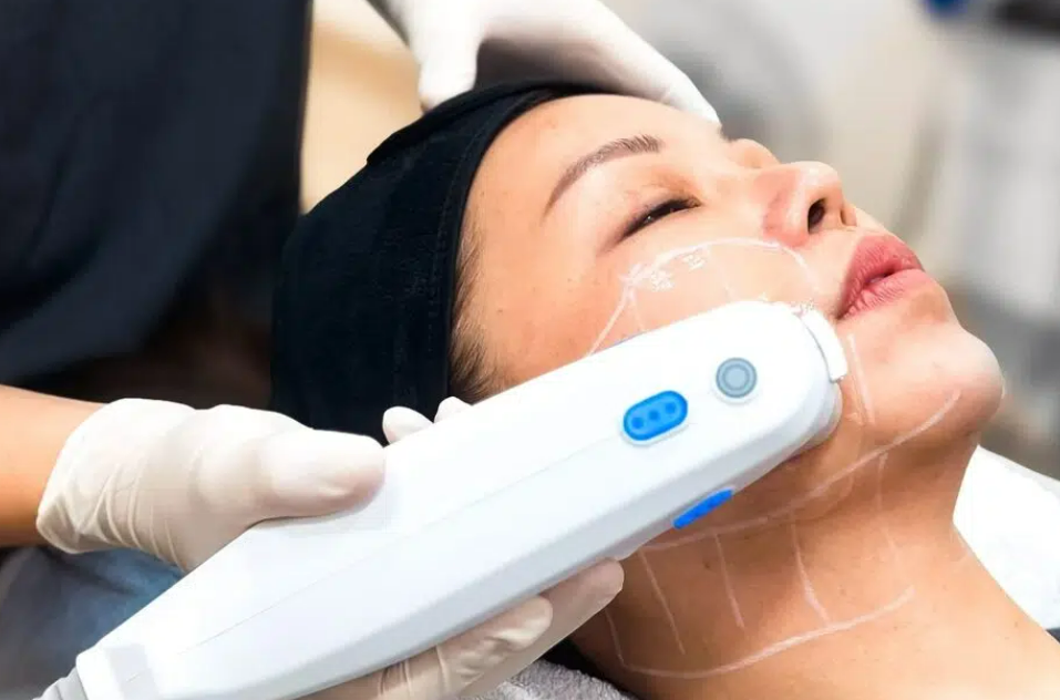 ultherapy treatment singapore